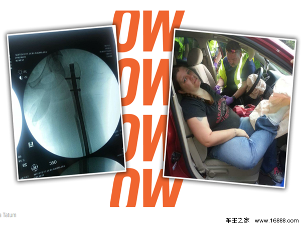 Put your foot on the central control, and after the airbag exploded, your foot broke yourself!